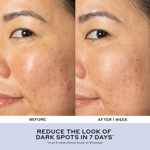 Best of Ole Skincare Essential Set