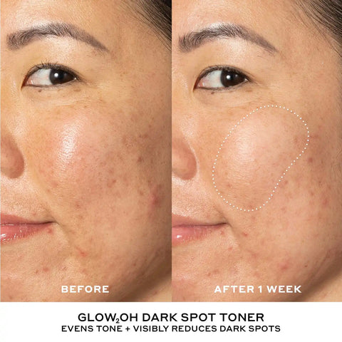 Best + Brightest Mini Skincare Starter Set