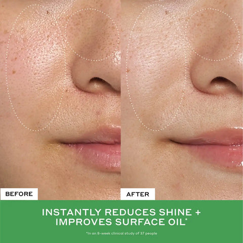 Detox Drops 2% Salicylic Acid Toner
