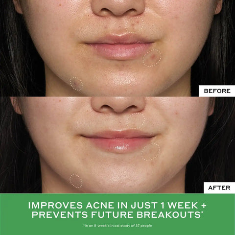 Detox Drops 2% Salicylic Acid Toner
