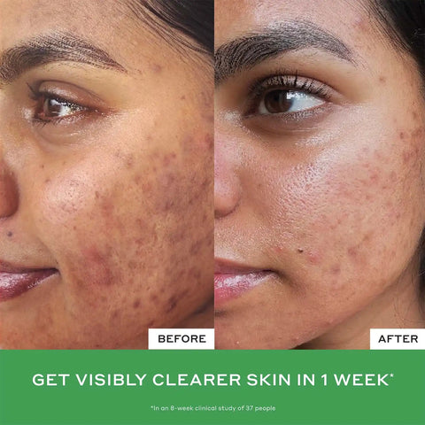 Mighty Minis Clinical Skincare Starter Set