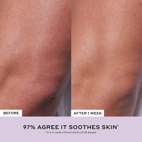 Après Skin Rich Rescue Barrier Moisturizer with Ceramides