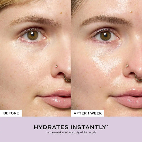 Après Skin Rich Rescue Barrier Moisturizer with Ceramides