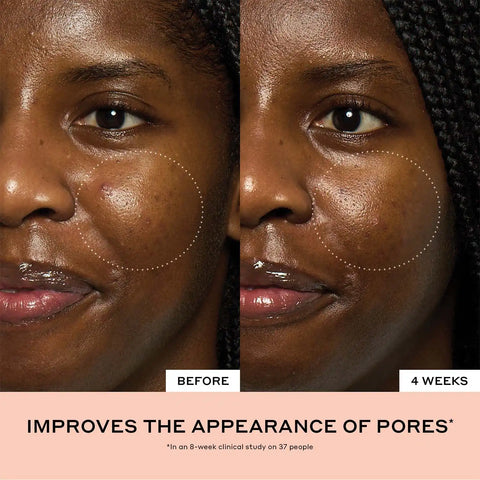 Peach Glaze Glow Niacinamide Serum with Vitamin C