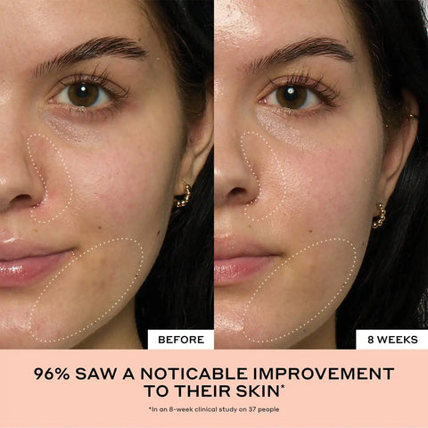 Peach Glaze Glow Niacinamide Serum with Vitamin C