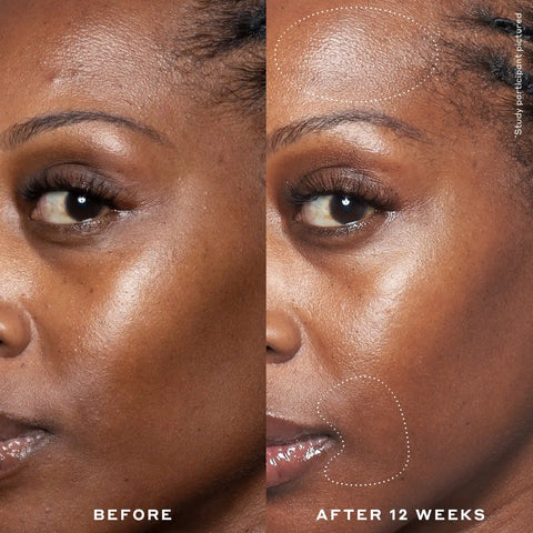 Renew + Strengthen Nighttime Skincare Routine